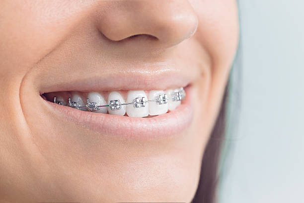 Best Invisalign and Clear Aligners  in Erie, IL